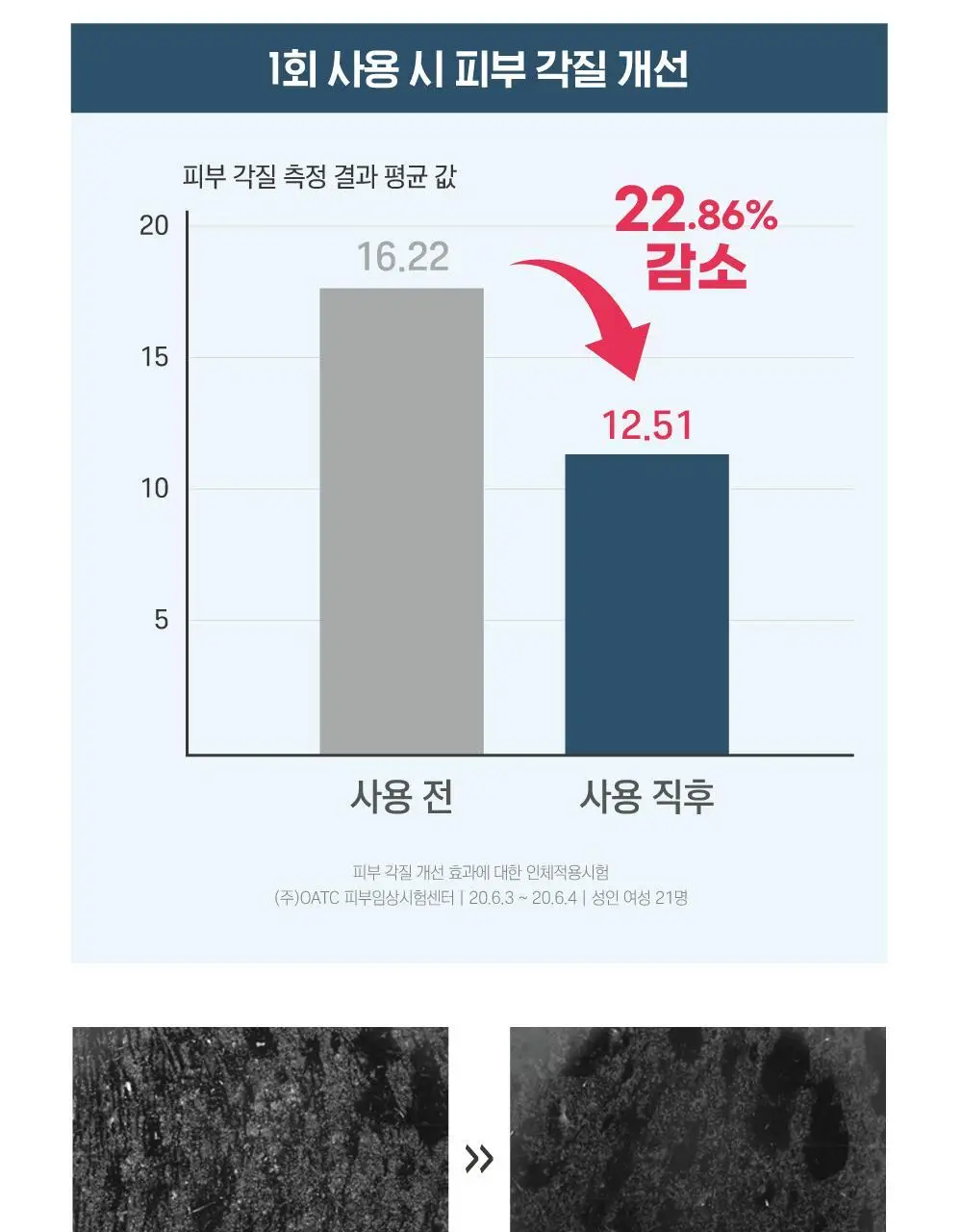 [고밀착/수분진정] 라운드랩 1025 독도 수분 워터겔 마스크 10매 상세페이지 16